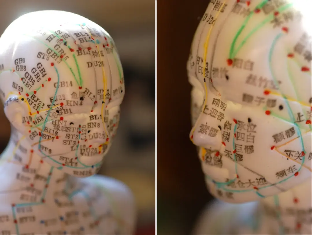 Trajets des méridiens  et des points d'acupuncture de la tête